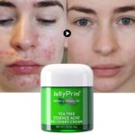 New Acne Face Cream Tea Tree Acne Remover Treatment Tool Facial Moisturizing Creams Whitening Pimple Mark Skin Care For Women